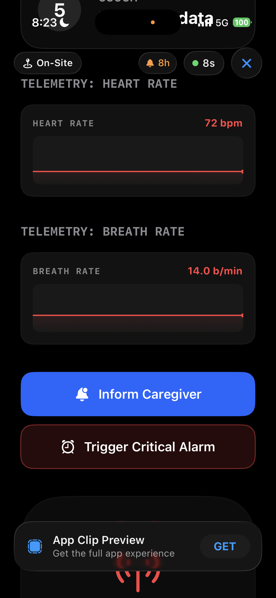 AEYRON telemetry — heart rate and breath rate